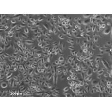 Human Bronchial Epithelial Cells (HBEpC)